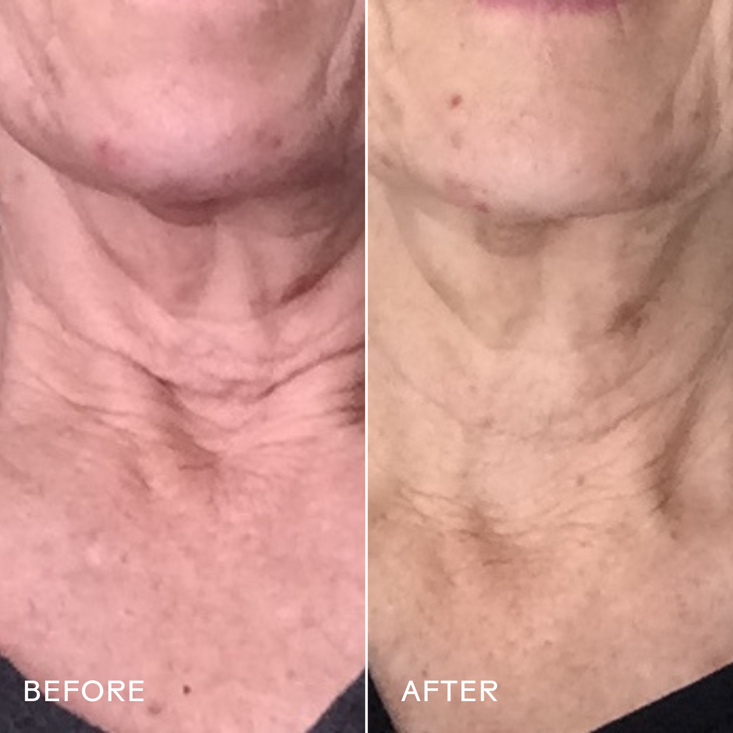 Firm Believer™ Goji Stem Cell + Pomegranate Smoothing Neck + Face Cream