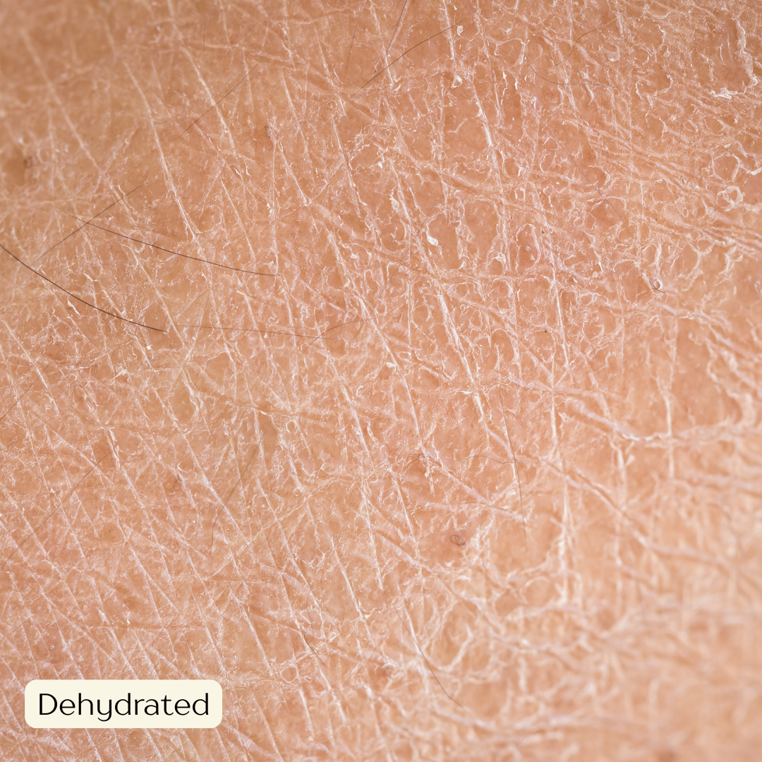 Dehydrated