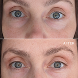 First Light Vitamin C + Caffeine Eye Cream