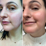 Skin Hero Calendula + 2% Bakuchiol Bio-Retinol Serum