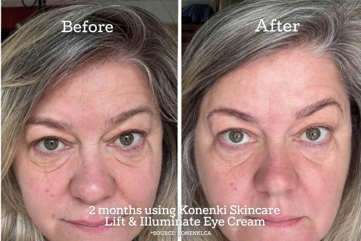 TWO MONTHS USING KONENKI EYE CREAM