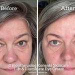 TWO MONTHS USING KONENKI EYE CREAM