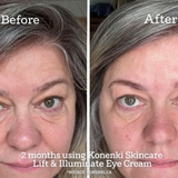 TWO MONTHS USING KONENKI EYE CREAM
