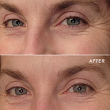 Eye Hero Bio-Retinol Smoothing Eye Cream